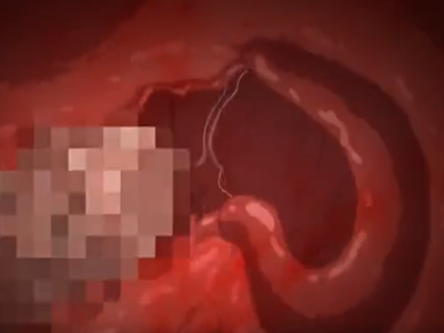 Thumbnail of post image 137