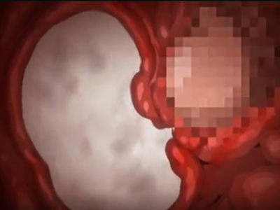 Thumbnail of post image 104