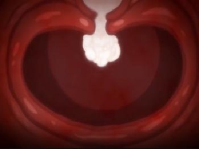 Thumbnail of post image 089