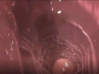 Thumbnail of post image 026