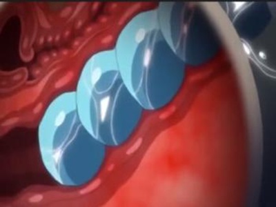 Thumbnail of post image 166