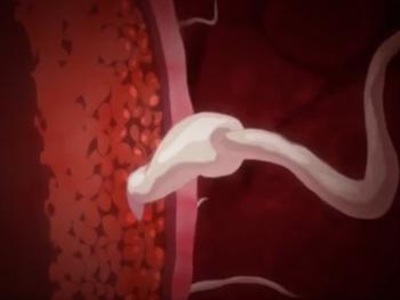 Thumbnail of post image 155